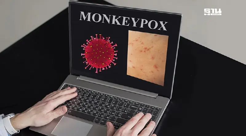 กรมวิทย์ เผย 24 จังหวัดทั่วไทย พร้อมตรวจฝีดาษวานร รู้ผลใน 24 ชม.