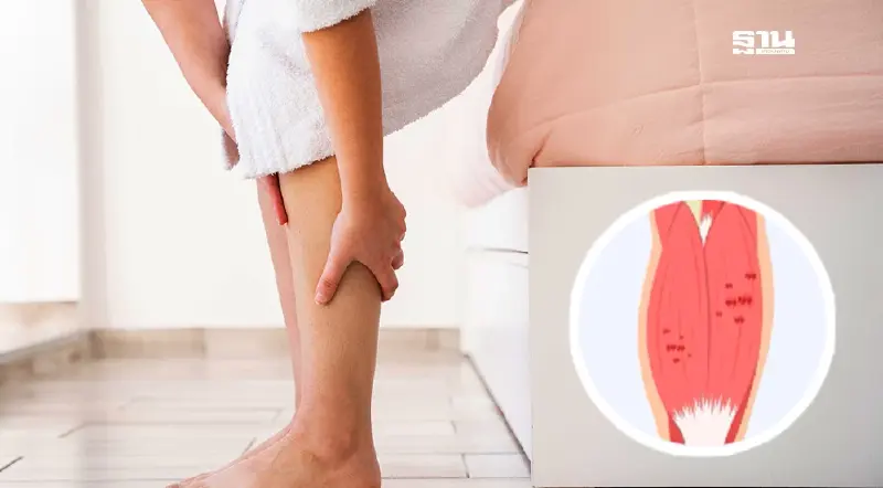 รู้ทัน IIMs: โรคกล้ามเนื้ออักเสบที่ต้องเฝ้าระวัง ภัยเงียบที่ควรรู้