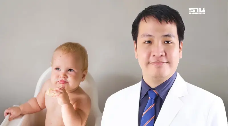 “ภูมิแพ้อาหารในเด็ก” ภัยร้ายที่พ่อแม่ไม่ควรละเลย