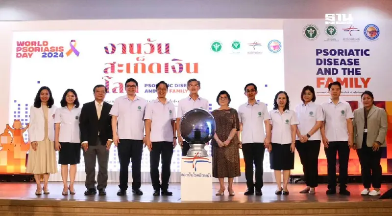 วันสะเก็ดเงินโลก 29 ตุลาคม สาธารณสุข ยกระดับรักษาแบบองค์รวม วันสะเก็ดเงินโลก 29 ตุลาคม สาธารณสุข ยกระดับรักษาแบบองค์รวม