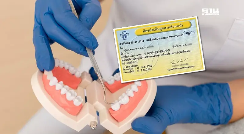 เปิดเงื่อนไข สิทธิบัตรทอง 30 บาท ใส่ฟันเทียม-รากฟันเทียมฟรี