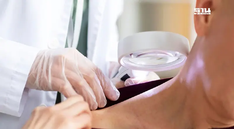 รู้จัก 'โรคพุ่มพวง' สาเหตุ อาการ และวิธีป้องกัน