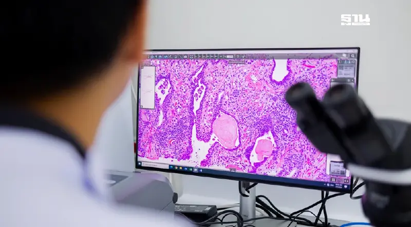 SiPH ร่วม IBM ยกระดับระบบสารสนเทศพยาธิวิทยาด้วยคอมพ์ขั้นสูง-AI