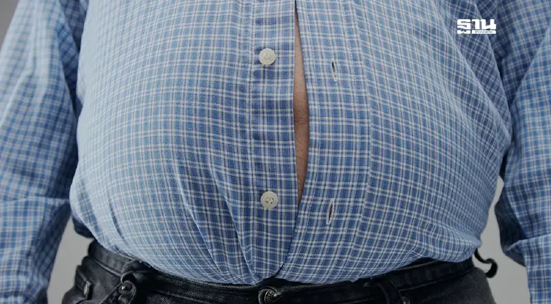 "โรคอ้วน" ภาวะอันตรายทำให้เกิดโรค NCDs "โรคอ้วน" ภาวะอันตรายทำให้เกิดโรค NCDs