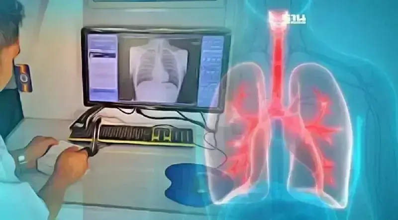 คนกรุง เช็คสุขภาพปอดฟรีด้วยรถเอกซเรย์เคลื่อนที่ 4-8 พ.ย.นี้ คนกรุง เช็คสุขภาพปอดฟรีด้วยรถเอกซเรย์เคลื่อนที่ 4-8 พ.ย.นี้