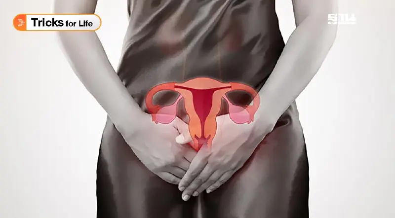 สัญญาณเตือนเสี่ยง “โรคช็อกโกแลตซีสต์”