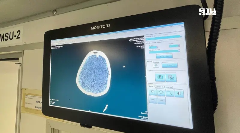 ทรู นำ 5G พลิกโฉม “สาธารณสุขอัจฉริยะ” หยุด“โรคหลอดเลือดสมอง”