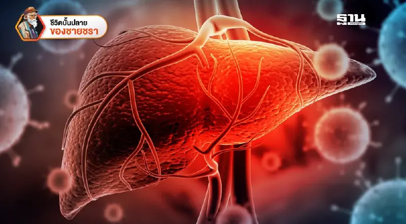 ความเหมือนและความต่างของไวรัสตับอักเสบ A และ B