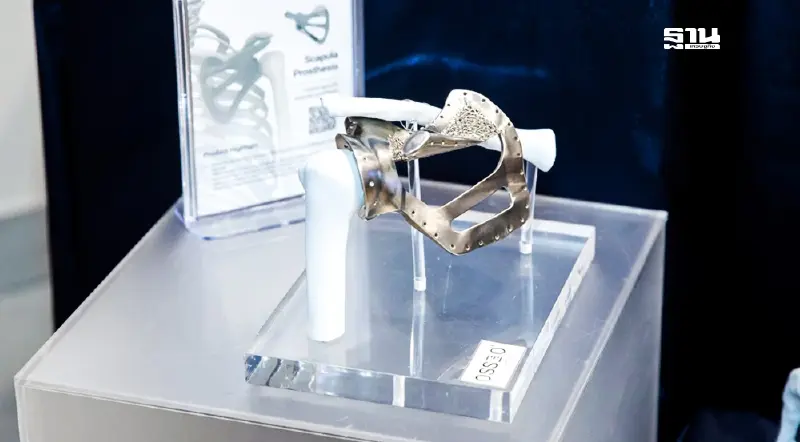 ครั้งแรกของโลก “รพ.ศิริราช” ผลิตกระดูกข้อสะโพกไทเทเนียม 3 มิติ