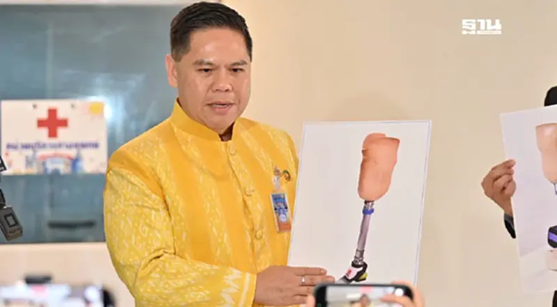 พม. มอบกายอุปกรณ์ นวัตกรรมขาเทียม ช่วยทหารโดนทุ่นระเบิดกัมพูชา พม. มอบกายอุปกรณ์ นวัตกรรมขาเทียม ช่วยทหารโดนทุ่นระเบิดกัมพูชา