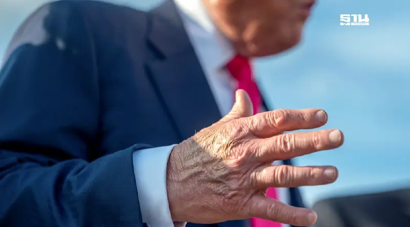 ทรัมป์ขาบวม-มือช้ำ! ทำเนียบขาวแจงด่วน สุขภาพผู้นำสหรัฐฯ มีอะไรน่ากังวล? ทรัมป์ขาบวม-มือช้ำ! ทำเนียบขาวแจงด่วน สุขภาพผู้นำสหรัฐฯ มีอะไรน่ากังวล?