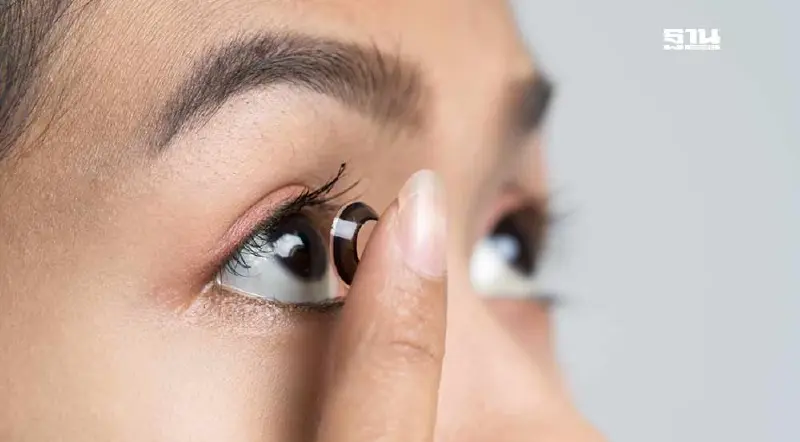 ใส่คอนแทคเลนส์ผิดวิธี เสี่ยง ‘แผลที่กระจกตา’ ถึงขั้นตาบอดถาวร ใส่คอนแทคเลนส์ผิดวิธี เสี่ยง ‘แผลที่กระจกตา’ ถึงขั้นตาบอดถาวร