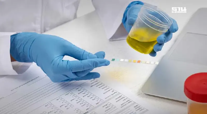 สปสช. แจงปมร้านยาตรวจคัดกรองโรคด้วยปัสสาวะ ย้ำแค่แจกชุด Self-Test สปสช. แจงปมร้านยาตรวจคัดกรองโรคด้วยปัสสาวะ ย้ำแค่แจกชุด Self-Test