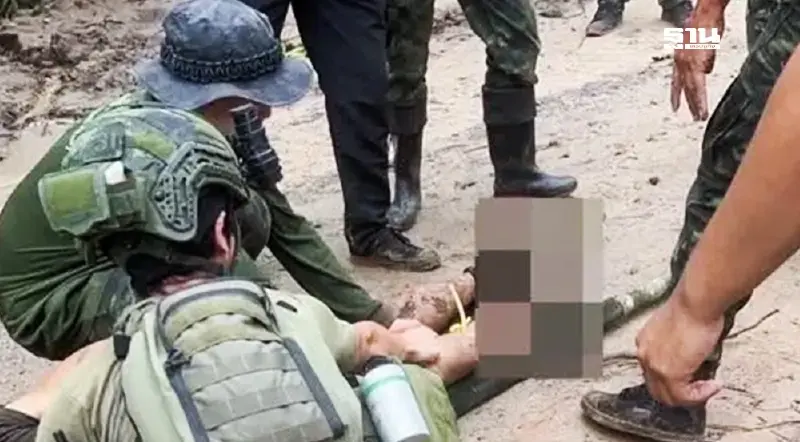 อีกแล้ว“ทหารไทย”เหยียบกับระเบิด ที่ปราสาทตาควาย ข้อเท้าขวาขาด