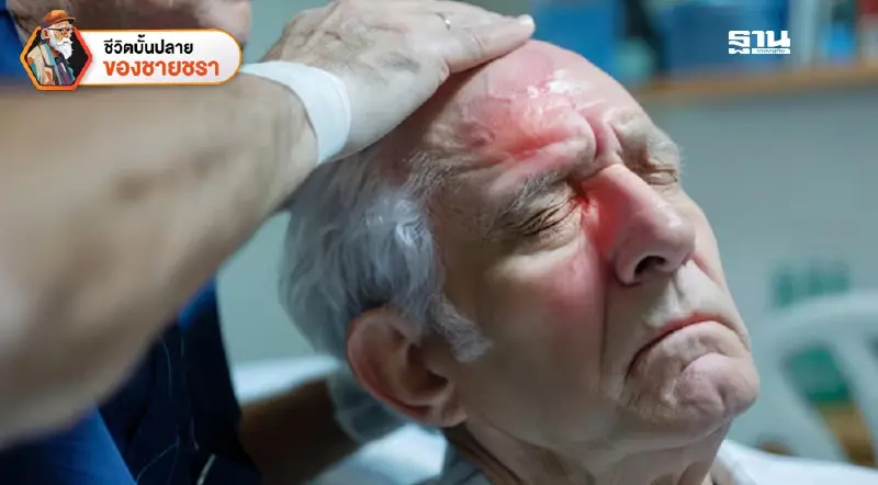 โรคหลอดเลือดสมอง (Stroke) ในผู้สูงวัย 2