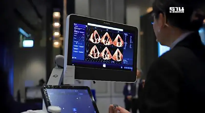 ฟิลิปส์ชู 3D Echo ยกระดับวินิจฉัยโรคหัวใจ รับวันหัวใจโลก ฟิลิปส์ชู 3D Echo ยกระดับวินิจฉัยโรคหัวใจ รับวันหัวใจโลก