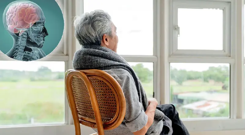‘อัลไซเมอร์’ โรคฮิตผู้สูงวัย สาเหตุ อาการ ปัจจัยเสี่ยง และการรักษา