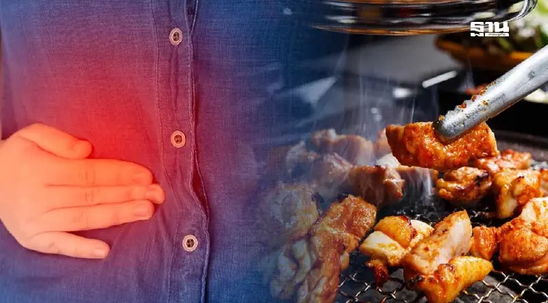 สายปิ้งย่าง รู้หรือยัง กินไม่ระวังเสี่ยงเป็น “นิ่วในถุงน้ำดี”