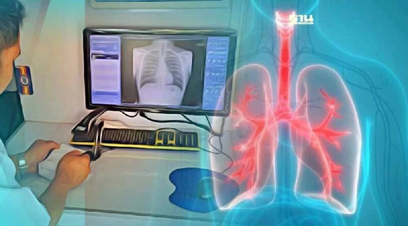 .รถเอกซเรย์เคลื่อนที่ 7 เขต กทม. ตรวจฟรี ใช้บัตรประชาชนใบเดียว.