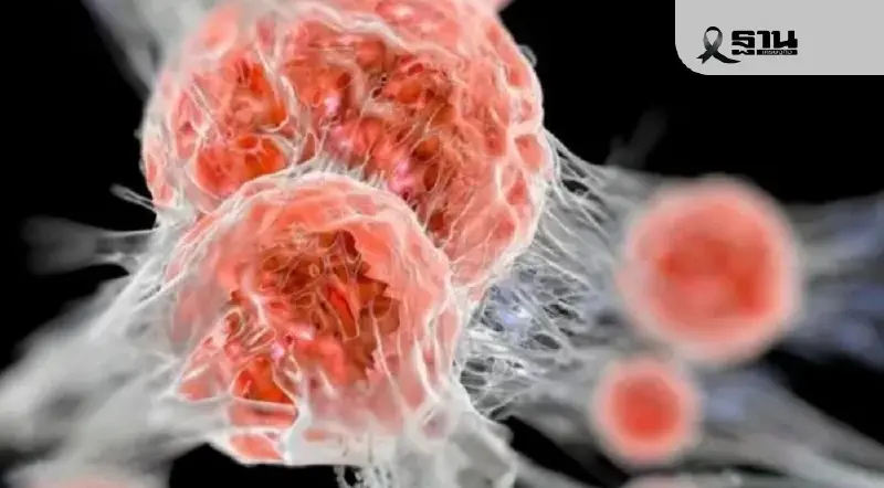 เปิดมุมมองแพทย์แผนจีน เสริมแกร่ง “ผู้ป่วยมะเร็ง” ด้วยการปรับ 3 สมดุล