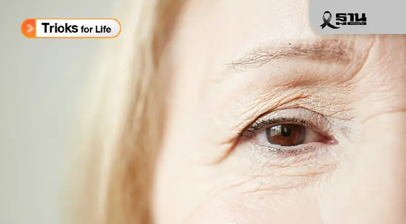 อย่ามองข้าม! 4 ตัวการ ต้นเหตุ ‘ต้อเนื้อ’ พร้อมวิธีสังเกตอาการ