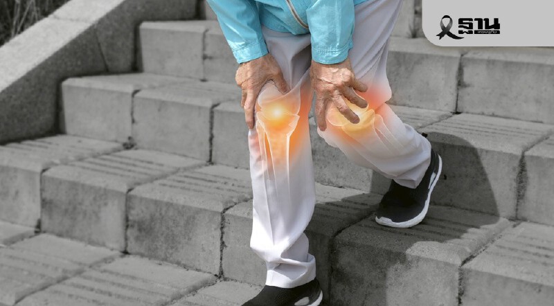 .'ข้อเข่าเสื่อม' โรคยอดฮิตในผู้สูงอายุ ระดับความรุนแรงแบบไหนต้องผ่าตัด.