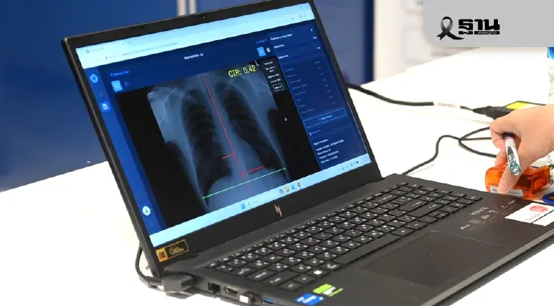 แอสตร้าฯ ร่วม กนอ. สร้างโมเดลสุขภาพยั่งยืน ใช้ AI ตรวจปอดแรงงานในนิคมฯ