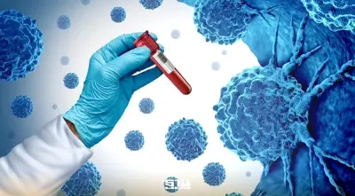 ยกระดับนวัตกรรมรักษา“มะเร็ง” พบคนไทยป่วยพุ่ง 1.4 แสนรายต่อปี