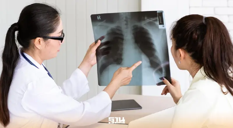 มีไข้เรื้อรังควรระวัง ‘วัณโรคปอด’ เสี่ยงติดเชื้อจากการไอ-จาม