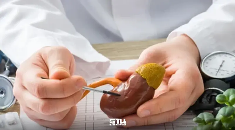 คนไทยป่วยโรคไตปีละ 7.8% สธ. เร่งคัดกรอง 7.2 ล้านคน ก่อนสายเกินแก้