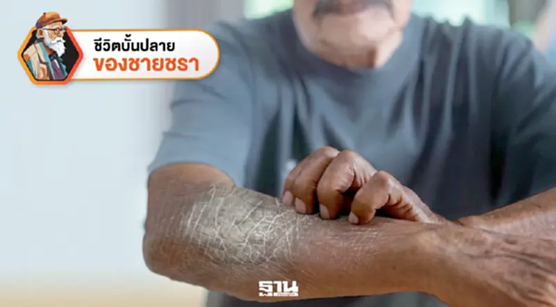 ผู้สูงวัยในวันที่ผิวหนังกลายเป็นหนังช้าง ผู้สูงวัยในวันที่ผิวหนังกลายเป็นหนังช้าง