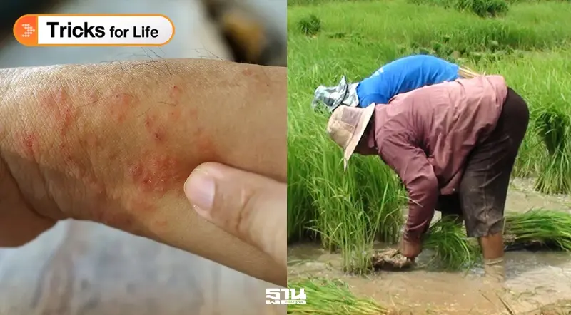 รู้จัก ‘โรคไข้ดิน’ กลุ่มเสี่ยง สาเหตุ หากมีอาการเหล่านี้ต้องรีบพบแพทย์