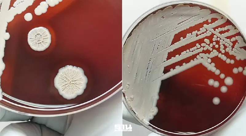 คนไทยป่วย โรคไข้ดิน พุ่ง กรมวิทย์ ชูตรวจแล็บครบวงจร รู้ผลไว ช่วยรักษาทันท่วงที