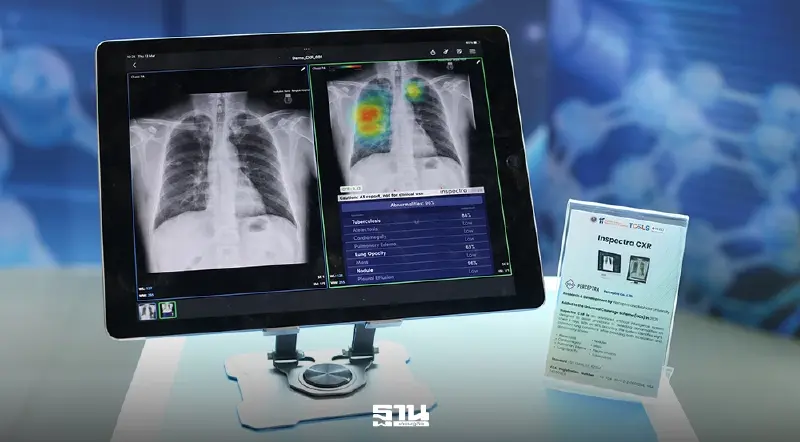 สปสช. ชูนวัตกรรมไทยลดงบนำเข้ายา-เครื่องมือแพทย์ ช่วยผู้ป่วยเข้าถึงการรักษามากขึ้น