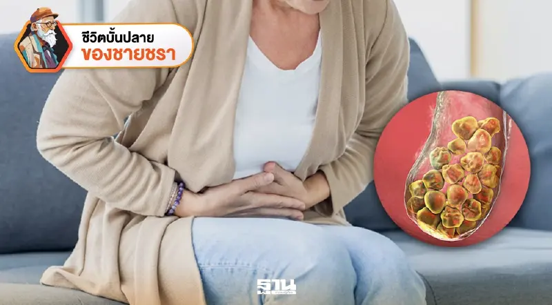 “นิ่วในถุงน้ำดี” ก้อนหินในพุงที่หญิงสูงวัยต้องระวังเป็นพิเศษ!