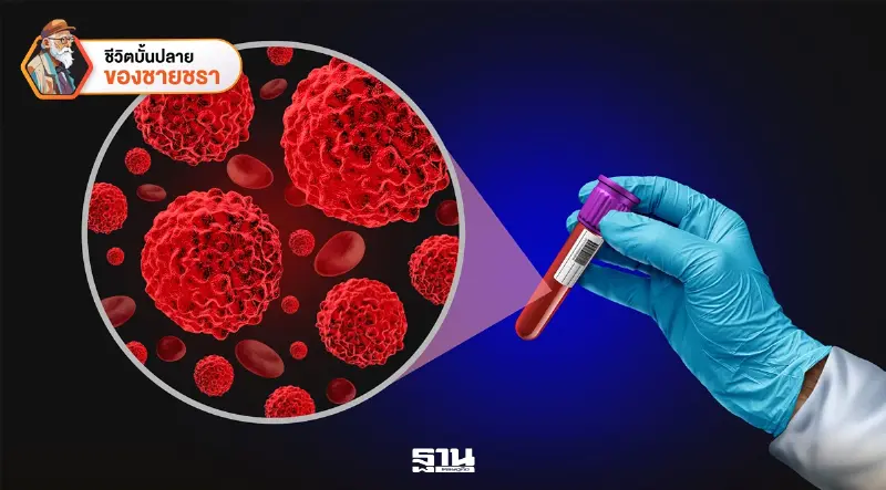 ก้าวถัดไปของสาธารณสุขไทย จากการตรวจมะเร็งแบบเดิม สู่ยุค Liquid Biopsy