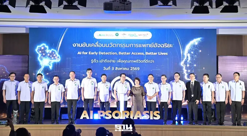 สธ. เปิดตัว AI Psoriasis นวัตกรรมอัจฉริยะคัดกรองโรคสะเก็ดเงิน